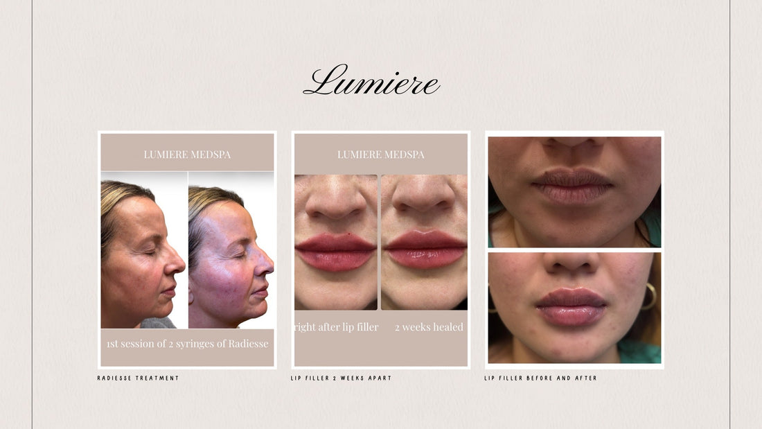 Your Arlington Heights Aesthetic Destination: Meet Lumiere Medspa