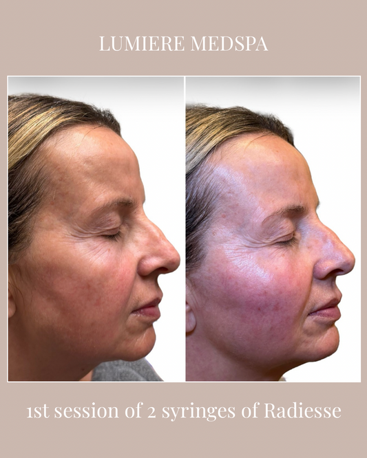 Why Most People Wait Too Long to Start Aesthetic Treatments and End Up Spending More